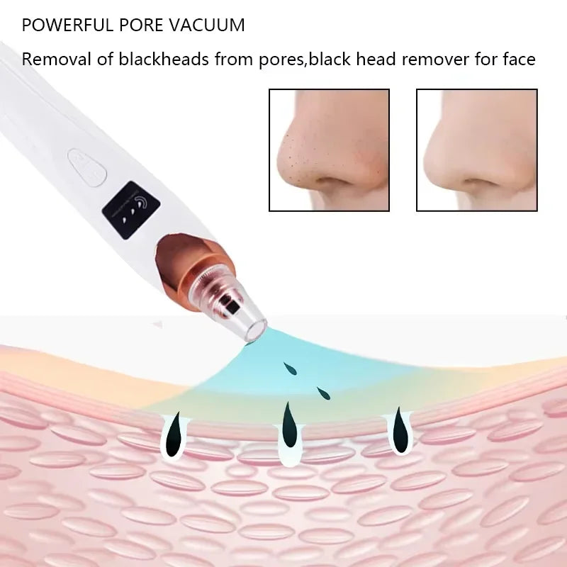 Electric Blackhead Remover Vacuum Suction USB Facial Pore Cleaner Spot Acne Pimple Black Head Extractor Face Clean Skin Care