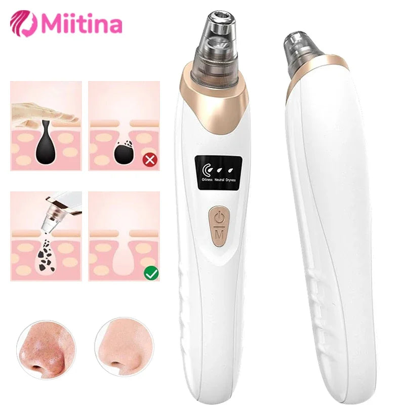 Electric Blackhead Remover Vacuum Suction USB Facial Pore Cleaner Spot Acne Pimple Black Head Extractor Face Clean Skin Care