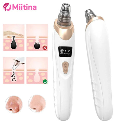 Electric Blackhead Remover Vacuum Suction USB Facial Pore Cleaner Spot Acne Pimple Black Head Extractor Face Clean Skin Care